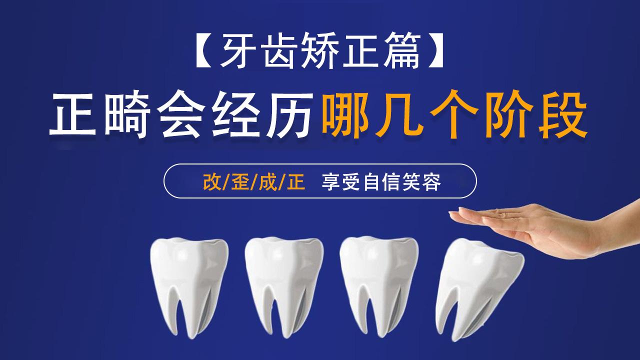 【牙齿矫正篇】矫正的过程是怎么样的？会经历哪几个阶段？