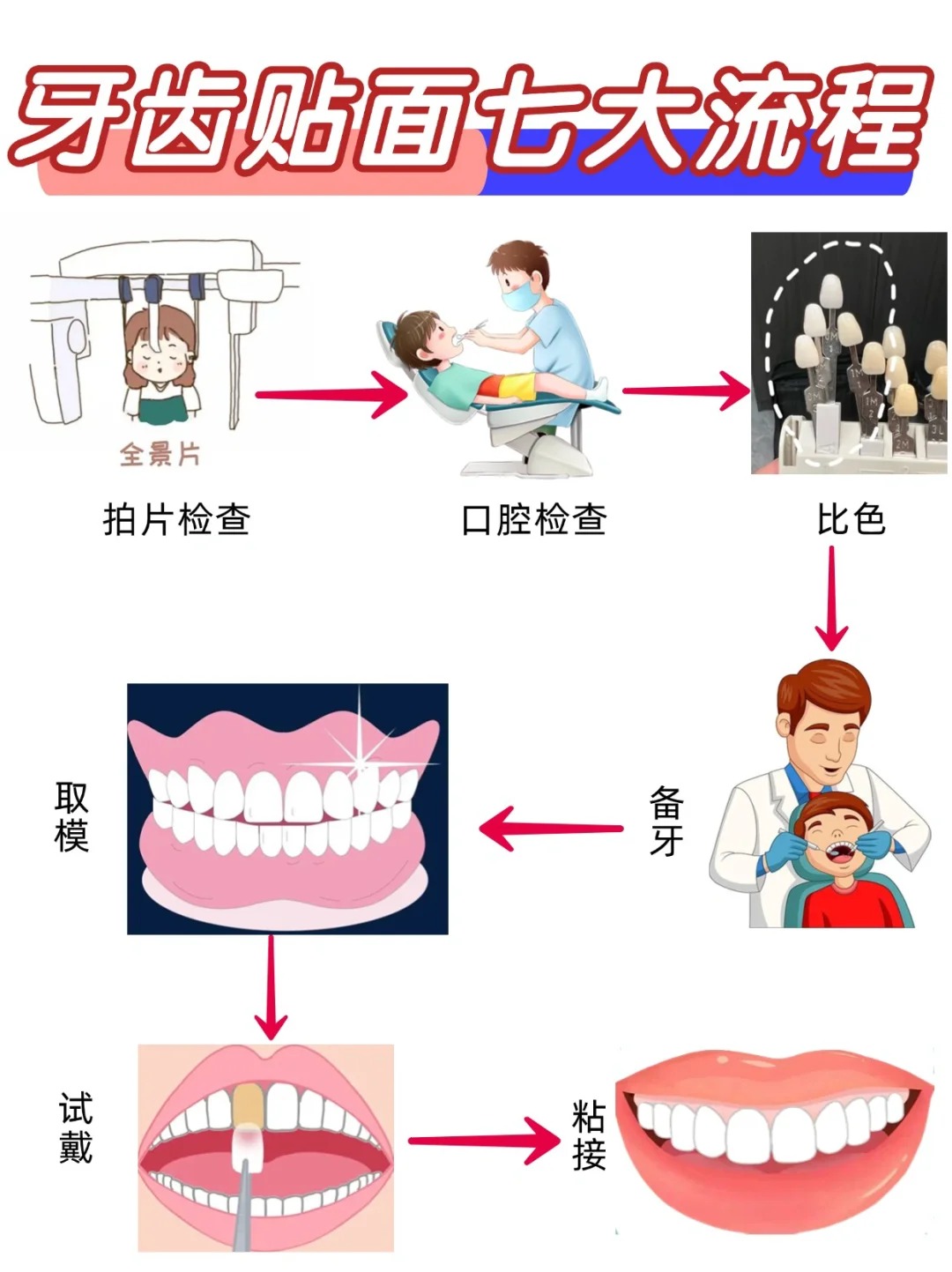 做牙齿贴面要多长时间？去医院几次？_1_上海牙齿贴面刘明星_来自小红书网页版.jpg