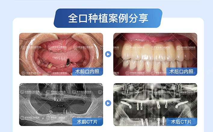 36787618.jpg tu 1.jpg