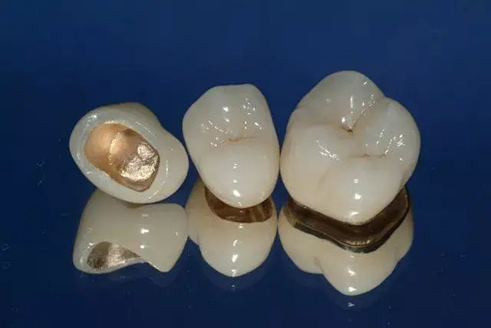 49560341.jpg tu 3.jpg