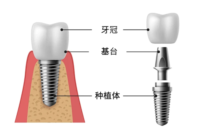 76939241.jpg tu 4.jpg