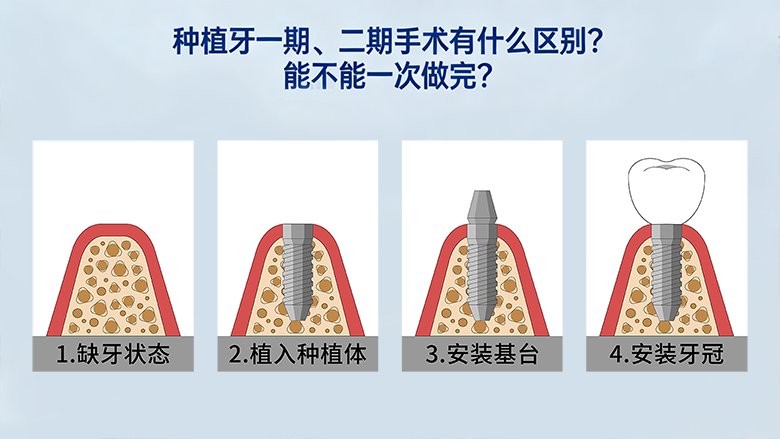 88565127.png 封面1.png