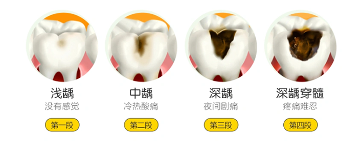 龋齿11.png